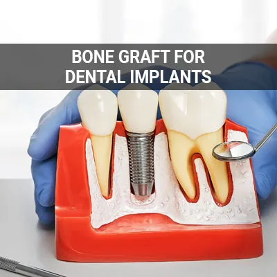 Visit our Will I Need a Bone Graft for Dental Implants page
