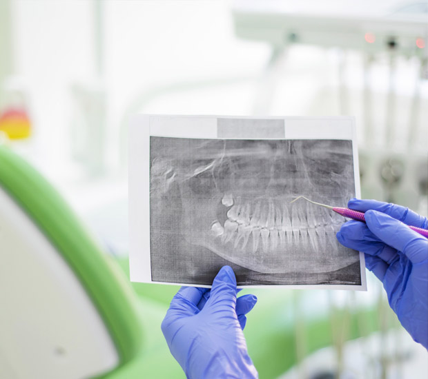 Los Angeles Periodontal Probing